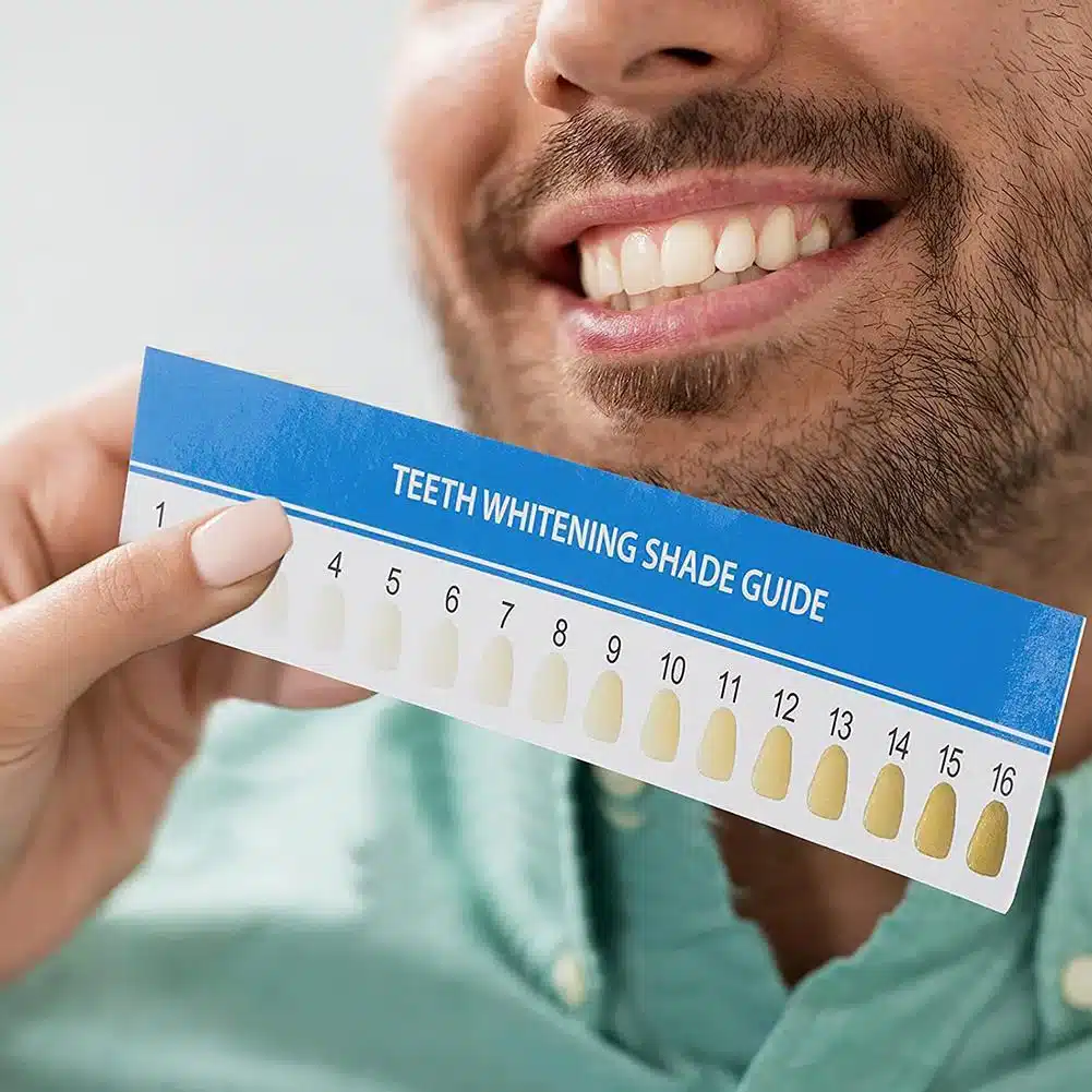 teeth_guide_white
